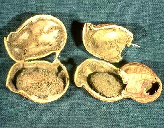 Aflatoxin6